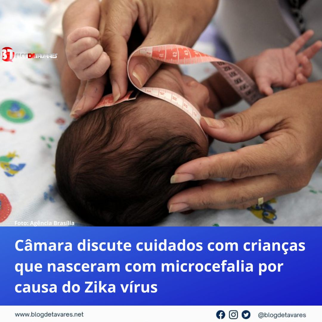 Câmara discute cuidados com crianças que nasceram com microcefalia por causa do Zika vírus 