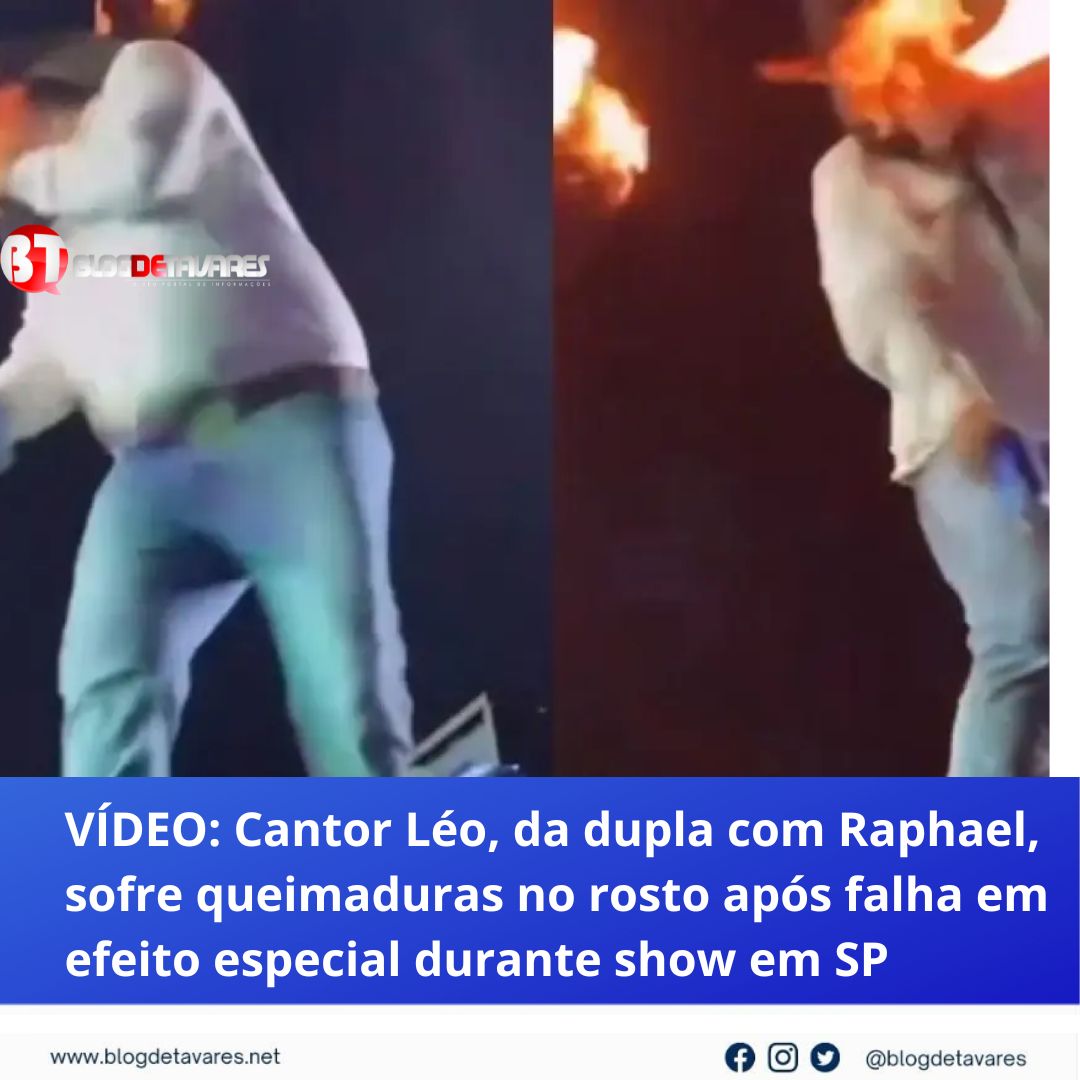 VÍDEO: Cantor Léo, da dupla com Raphael, sofre queimaduras no rosto após falha em efeito especial durante show em SP