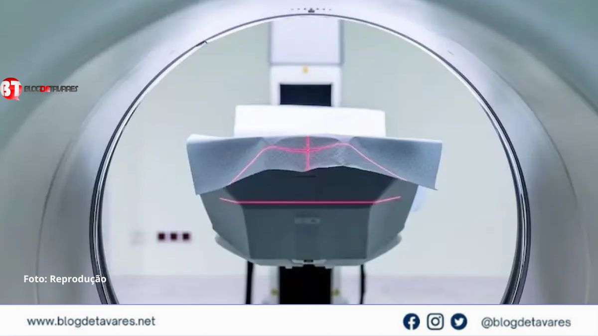  Homem morre após ser puxado por máquina de ressonância magnética nos EUA 
