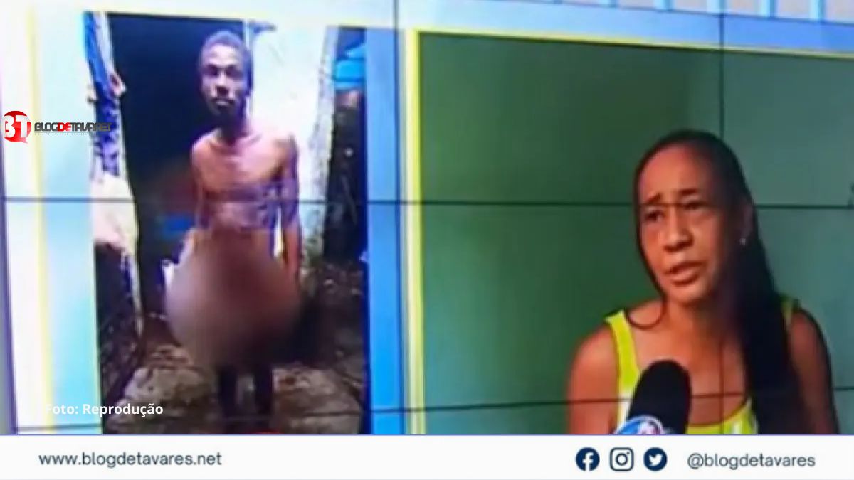 Após uso de Tadalafila, homem tem ereção por 15 dias e passa por cirurgia de emergência 