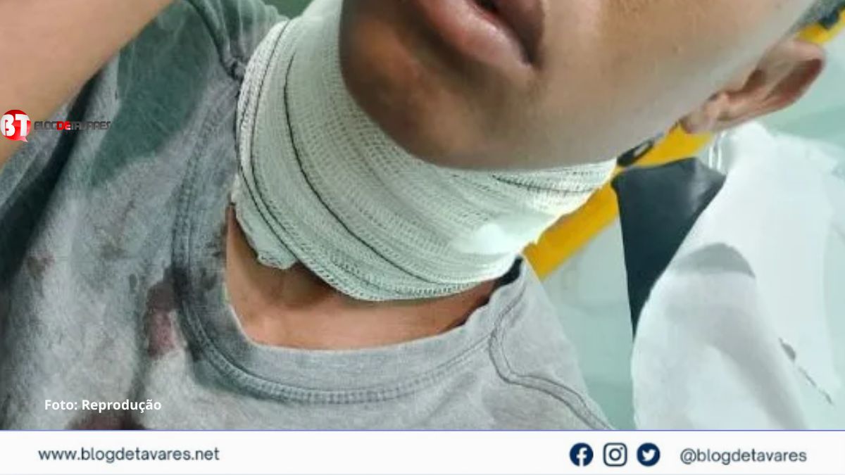 Jovem sofre grave acidente com linha de pipa com cerol em Terra Nova 