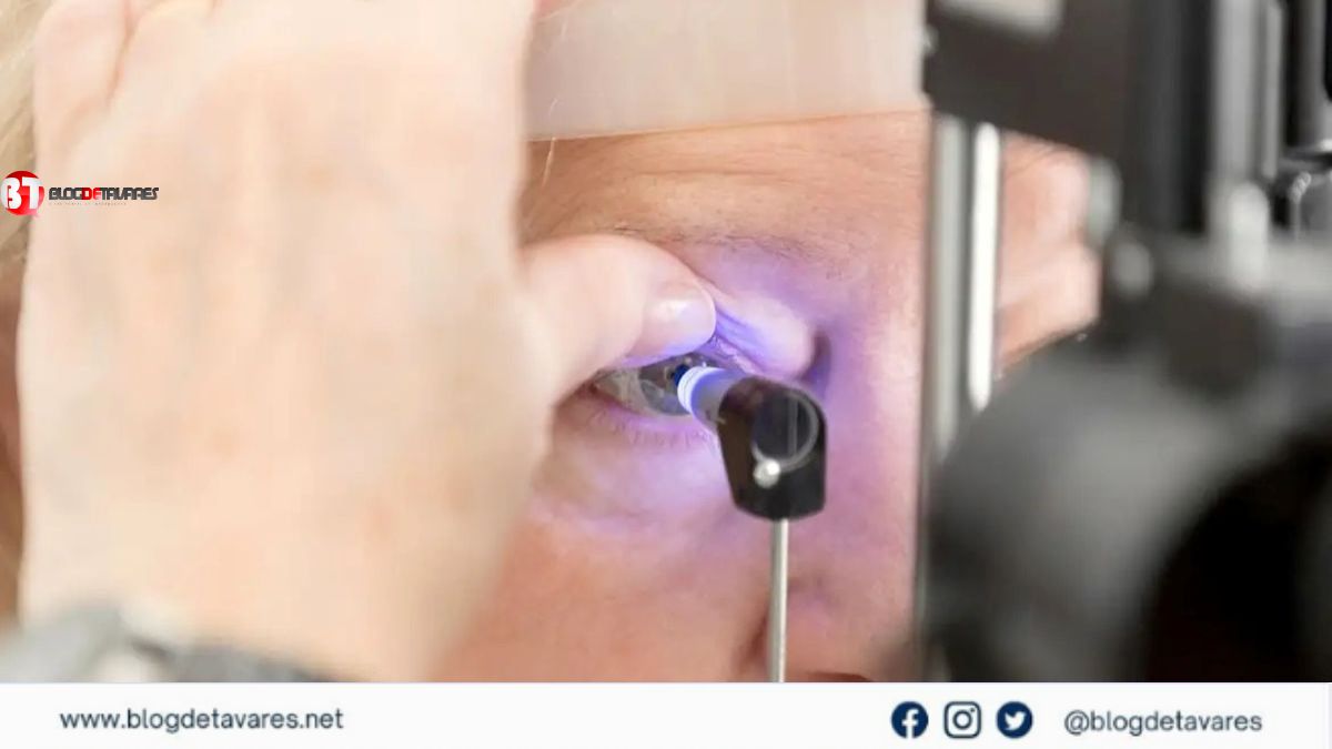 Uso de inteligência artificial avança como ferramenta no enfrentamento do glaucoma 
