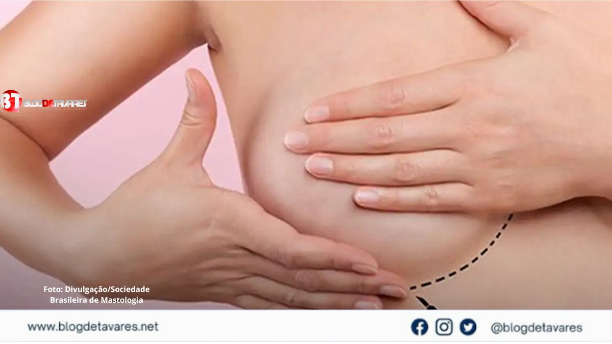 Inca estima 73,6 mil novos casos de câncer de mama no Brasil em 2025 