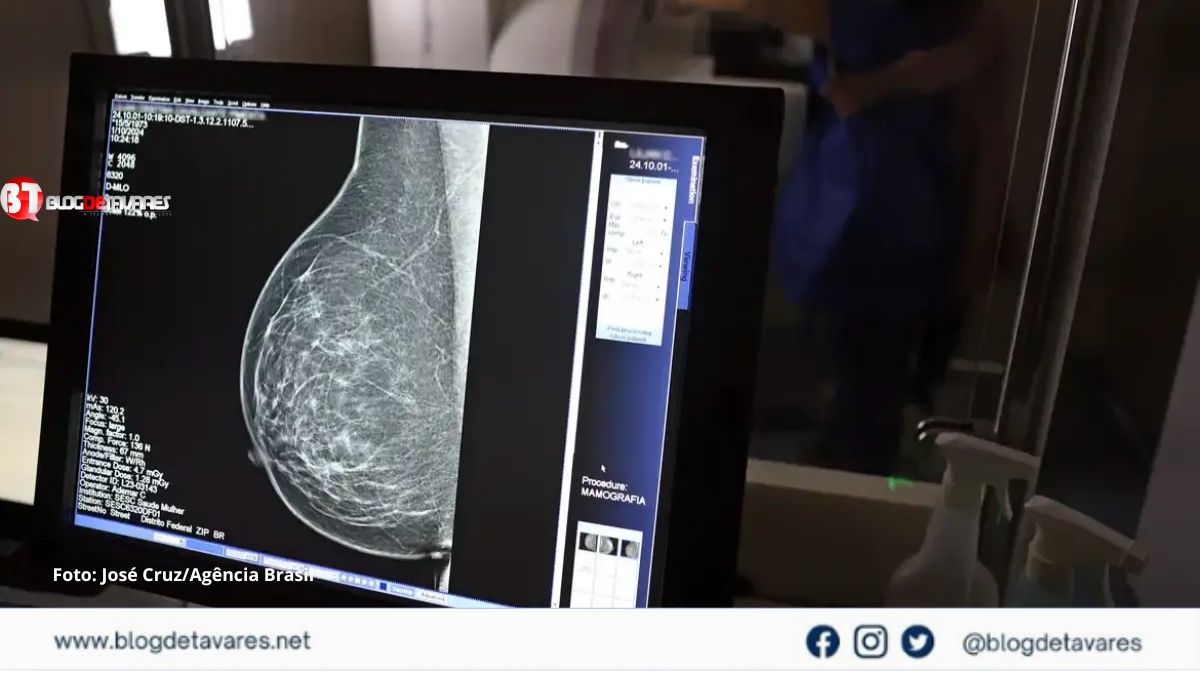 Médico diz que mamografia a partir dos 40 aumenta chances de cura de câncer em até 30% 