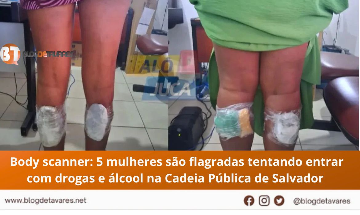 Body scanner: 5 mulheres são flagradas tentando entrar com drogas e álcool na Cadeia Pública de Salvador 