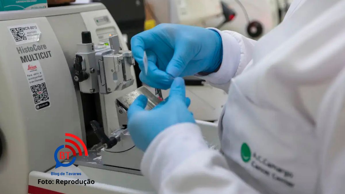 SUS inclui nova terapia para pacientes adultos com leucemia mieloide 