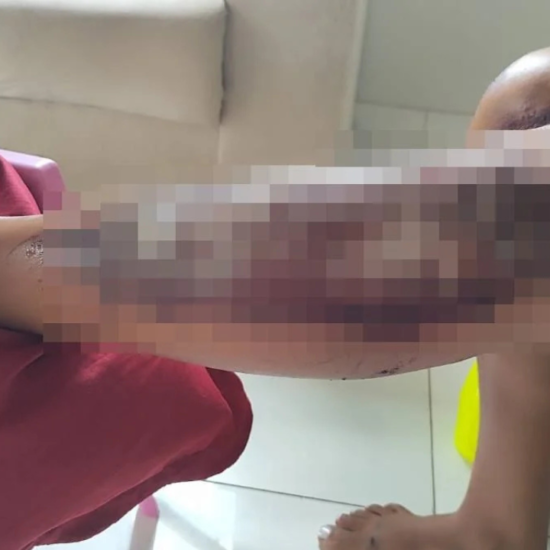 Motorista arrasta ex-companheira pelo asfalto com o carro em Feira de Santana 