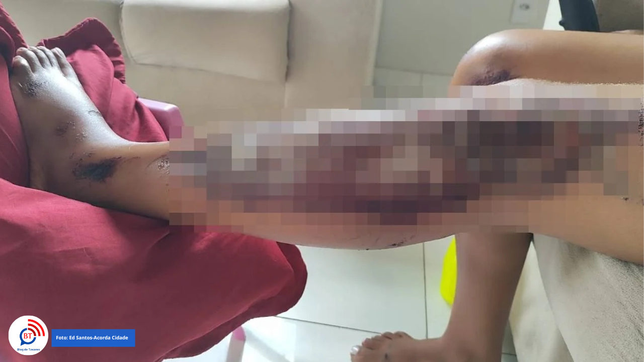 Motorista arrasta ex-companheira pelo asfalto com o carro em Feira de Santana 