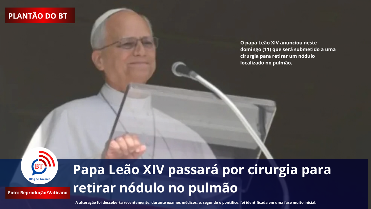 Papa Leão XIV passará por cirurgia para retirar nódulo no pulmão 